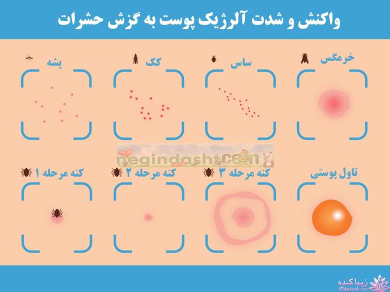 گزش پوستی حشرات